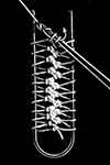 Hairpin Lace
